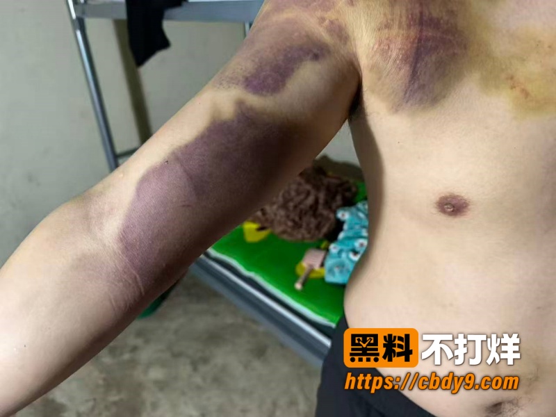 穆昌俊缅甸暴打 8