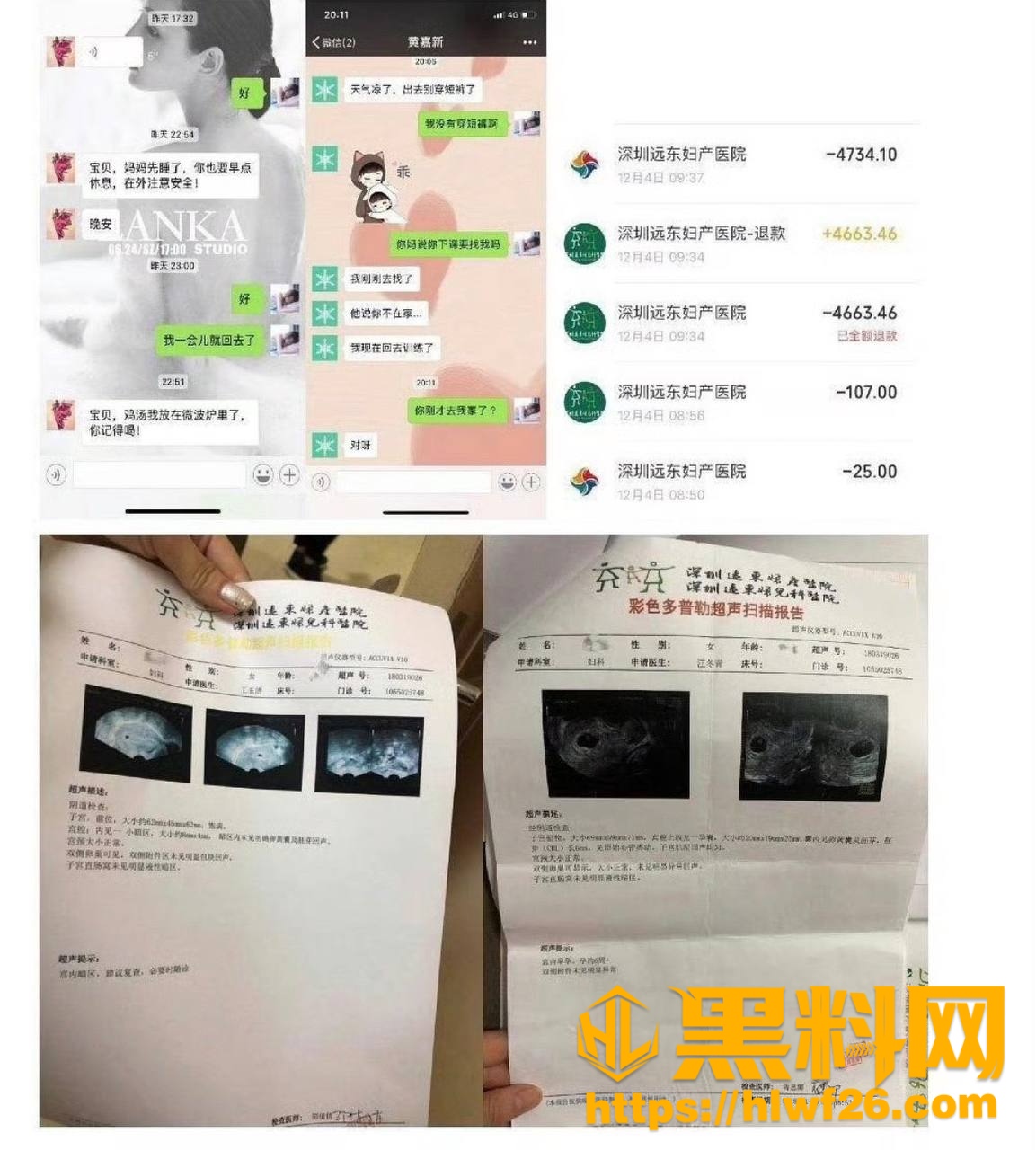 小兔软糖 9
