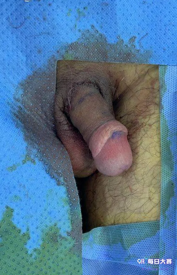 Post content image